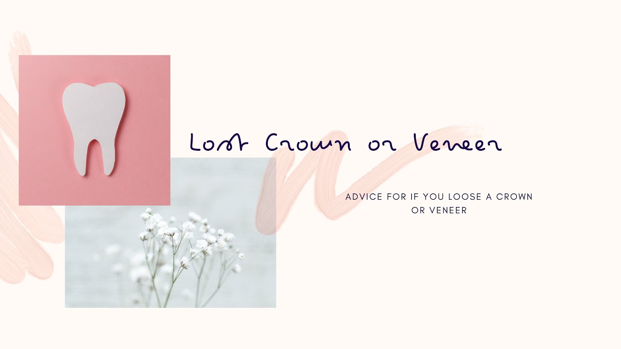 Have you lost a crown or veneer? - THE dentist, Salisbury